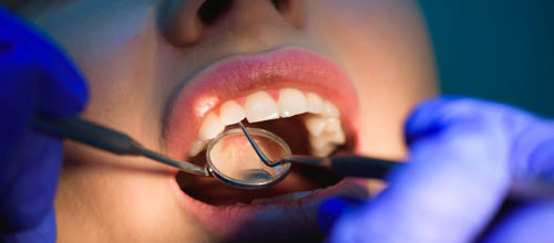 Gratis tandpleje til unge under 22 år